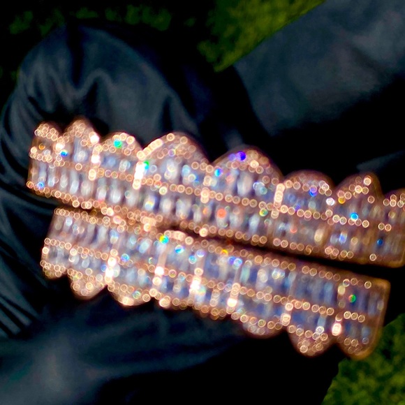 COPY - Rose gold baguette grillz set - Picture 6 of 8
